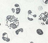 Слика приказује бактерију гонокок која је изазивач полне болести трипера а на препарату је представљен у виду интрацелуларних мрља у облику кафе.